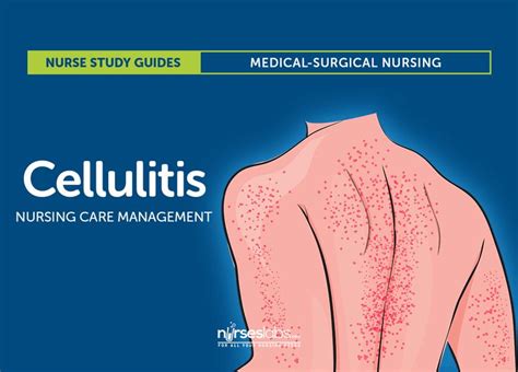 Cellulitis Nursing Care And Management Study Guide Nursing Study
