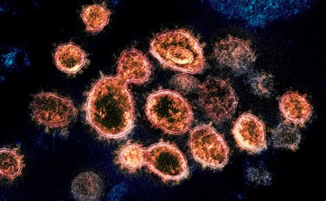 Covid 19 El Coronavirus Sobrevive En La Piel Hasta Nueve Horas