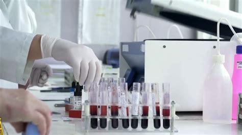 Blood Test Can Detect Recurrence In Some Cancers Youtube