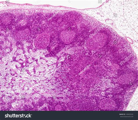 Histological Section Lymph Node Showing Cortex Foto Stock Modifica