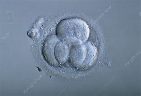 Light Micrograph Of A Four Cell Embryo Stock Image P6800498