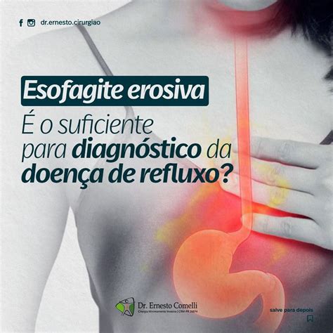 Esofagite Erosiva É suficiente para o diagnóstico da doença do refluxo Dr Ernesto Comelli