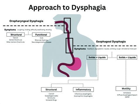 Approach To Dysphagia Gi And Hepatology News