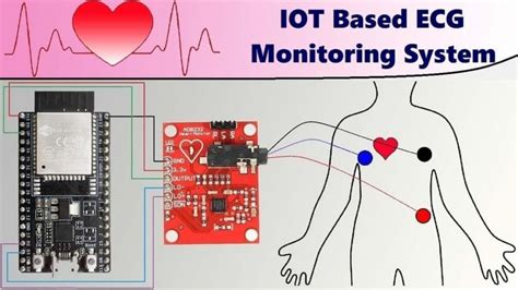 Iot Based Patient Health Monitoring System Using Esp And Arduino Images