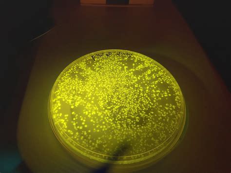 Fluorescent E Coli Time Scavengers