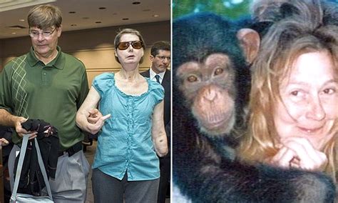 Chimpanzee Attack Victim Charla Nash Denied Permission To Sue