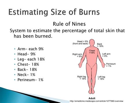 Ppt Medical Nutrition Therapy For Burn Patients Powerpoint