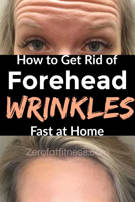 How To Get Rid Of Forehead Wrinkles Naturally Fast With 10 Home