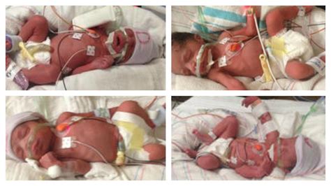 Phoenix Woman Dies After Giving Birth To Quadruplets Chicago Tribune