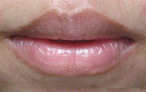 These can arise due to a number of reasons. infection on lips - pictures, photos