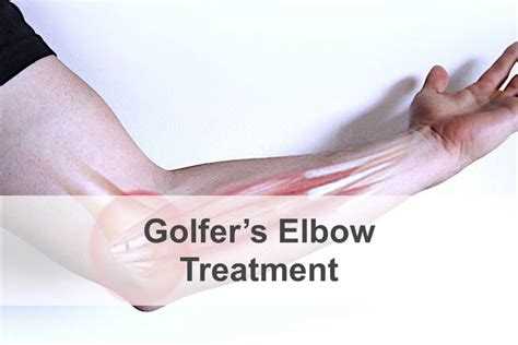 Treatment For Golfers Elbow Ortholazer Newburgh Ny
