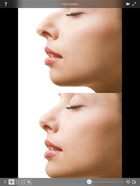 Plastic surgery iphone app created for dr. Plastic Surgery simulator Lite on the App Store