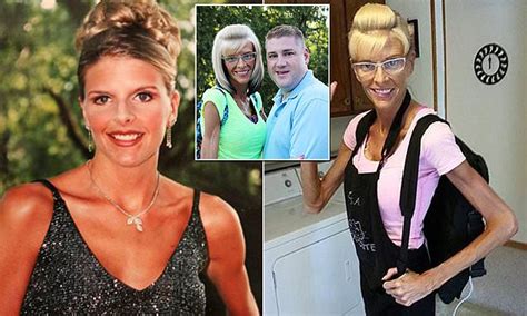 ex model lisa brown starving to death from rare disease daily mail online