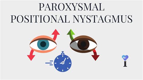 Paroxysmal Positional Nystagmus Overview Causes Symptoms Treatment