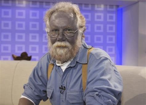 Man Who Turned Blue After Taking Silver For Skin Condition Dies New