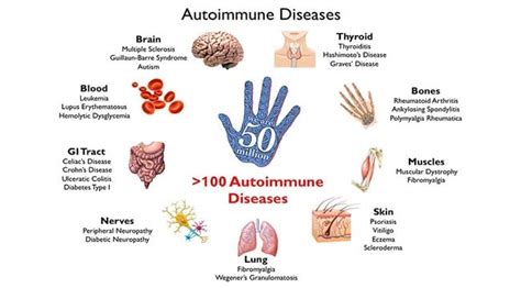 Autoimmune Disease Definition Types And Examples