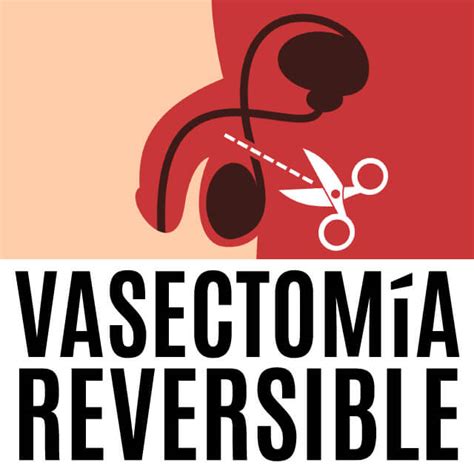 Vasectomía Reversible Cdmx Consulta Precio Clínica De Urología Cdmx
