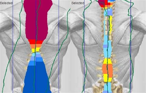 what is thermography prs chiropractic