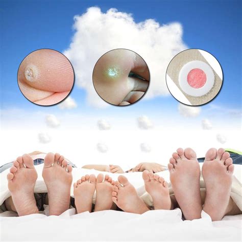 36pcsbox Foot Corn Removal Plaster With Hole Warts Thorn Patch Feet