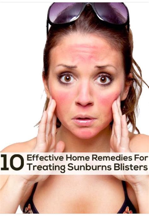 10 Effective Home Remedies For Treating Sunburn😱🌝🌞 Home Remedies
