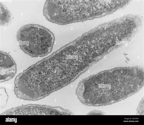 La E Coli 0157h7 Las Bacterias Micrógrafo Electrónico De