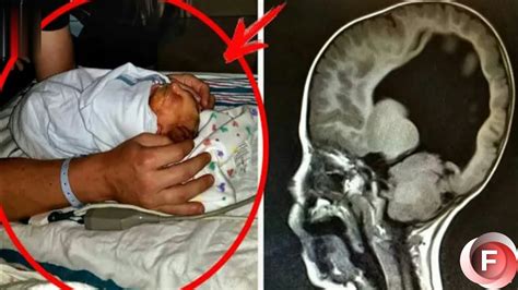 This Child Was Born Without Brain After 3 Years Doctors Reveals