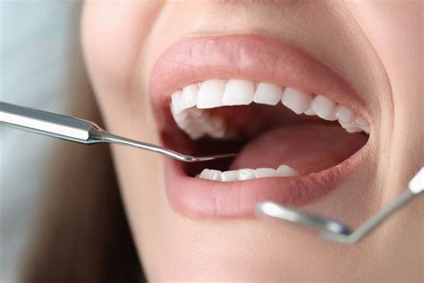 ¿cada Cuánto Es Necesario Ir Al Dentista Clínica Dental Puerta De Toledo