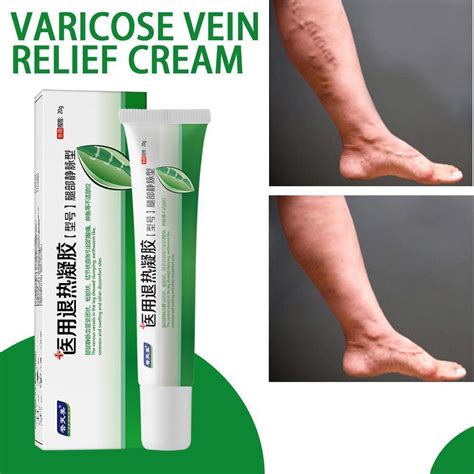 Effective Varicose Veins Relief Cream Relieve Ubuy India