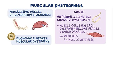 Muscular Dystrophies Duchenne And Becker Nursing Osmosis Video Library