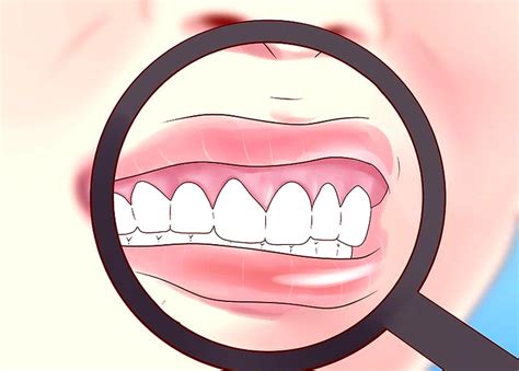 Oral Cancer Top 10 Mouth Cancer Symptoms Directorio Odontológico