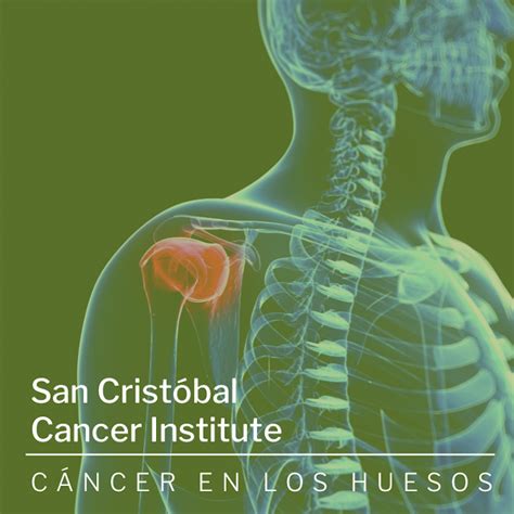 Información Sobre Cáncer De Hueso San Cristóbal Cancer Institute