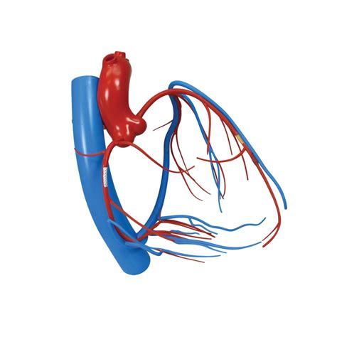 The pressure injures the artery, the immune system sends out white blood cells to remove injured tissue. Coronary Arteries and Cardiac Veins - Model #2575