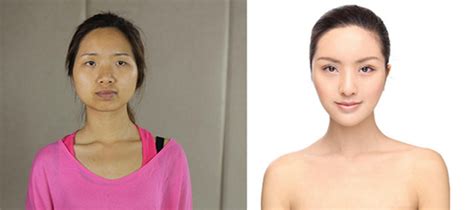 More Crazy Photos Of Chinese Plastic Surgery Amped Asia