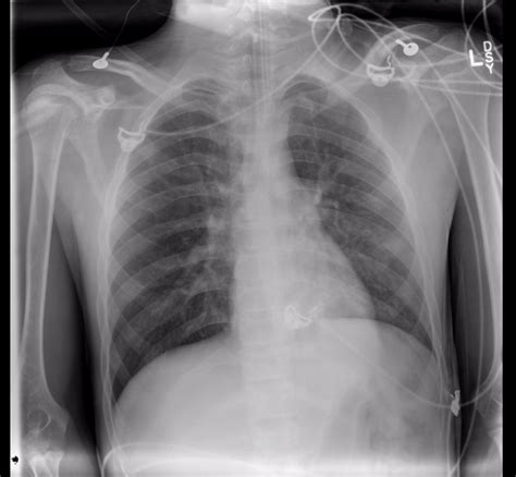 General Approach To Reviewing X Ray Imaging Undergraduate Diagnostic