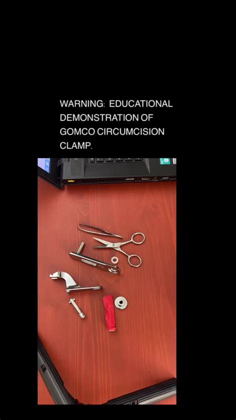 Newborn Circumcision The Gomco Method