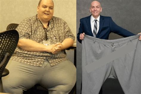Man Refuses Surgery He Loss 270 Pounds With This Natural Drink India Tv Hindi
