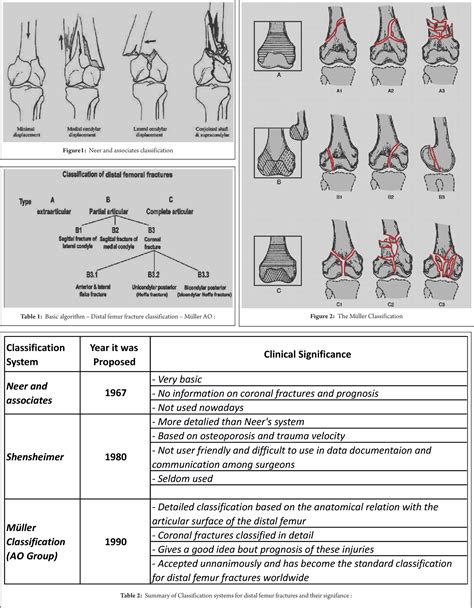 Pdf Classification Of Distal Femur Fractures And Their Clinical The
