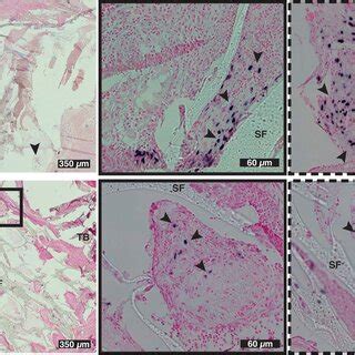 Alu Ish With A Counter Nuclear Fast Red Stain On Sections Of Cs Download Scientific Diagram