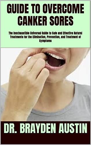 Guide To Overcome Canker Sores The Inexhaustible Universal Guide To