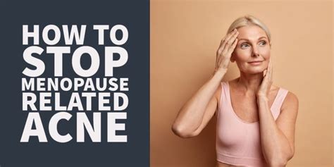 How To Treat And Stop Menopause Related Acne