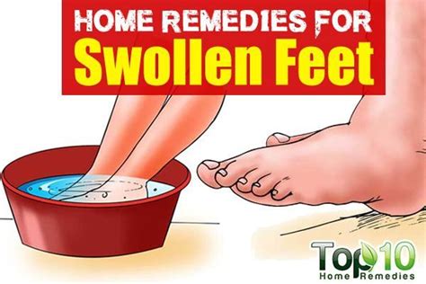 Home Remedies For Swollen Feet Top 10 Home Remedies