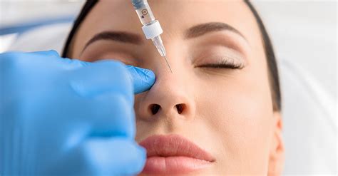 5 Things You Need To Know Before Getting Dermal Fillers Sd Botox