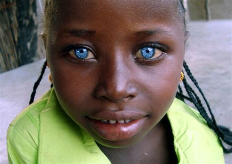 Black Person With Blue Eyes And Blonde Hair