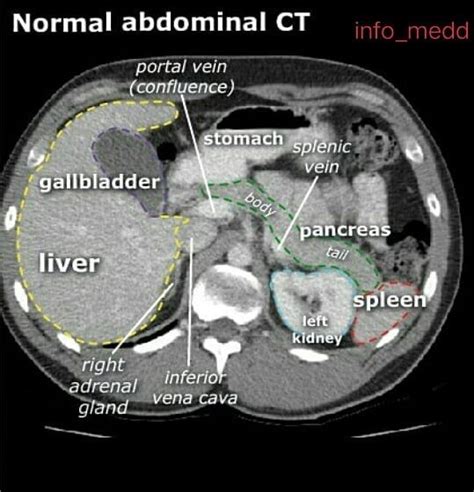 Read More And Download Book Immediately Abdominal Ct Transverse View