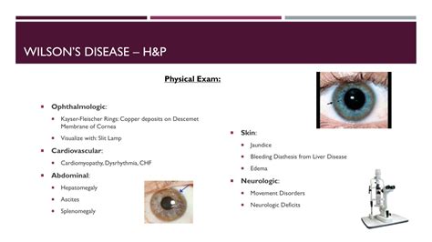 Ppt Wilsons Disease Powerpoint Presentation Free Download Id8821952