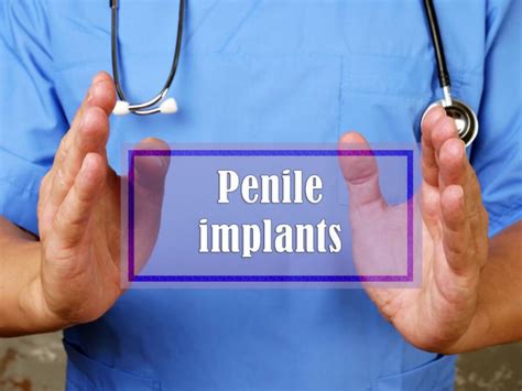 10 Facts About Penile Implants For Erectile Dysfunction Ed Online