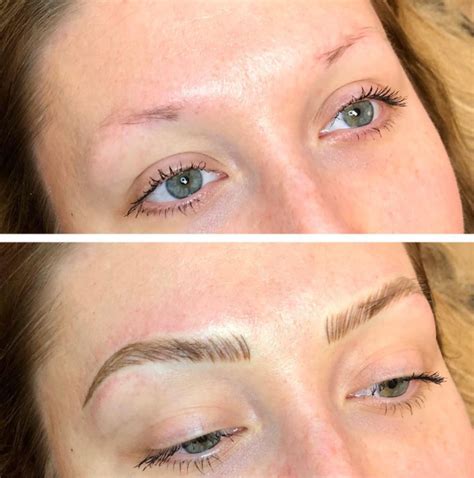 Thinning Eyebrows Common Causes Best Microblading In Frisco