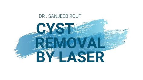 Cyst Removal By Laser Dr Sanjeeb Rout Youtube