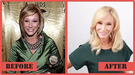 Paula White Plastic Surgery Though Paula White Didnt Admit Having Cosmetic Surgery Done