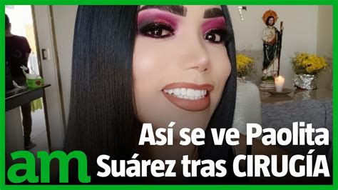 Así se ve Paolita Suárez de LAS PERDIDAS tras su CIRUGÍA de